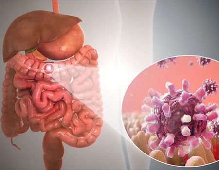 detail-main-Gastroenteritis-Demystified