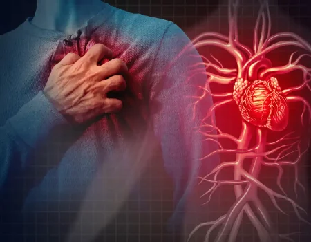 Rheumatic Heart disease